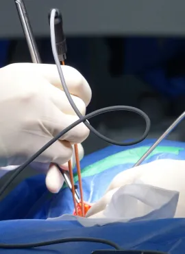 Especialista en Estenosis Lumbar en Tepic